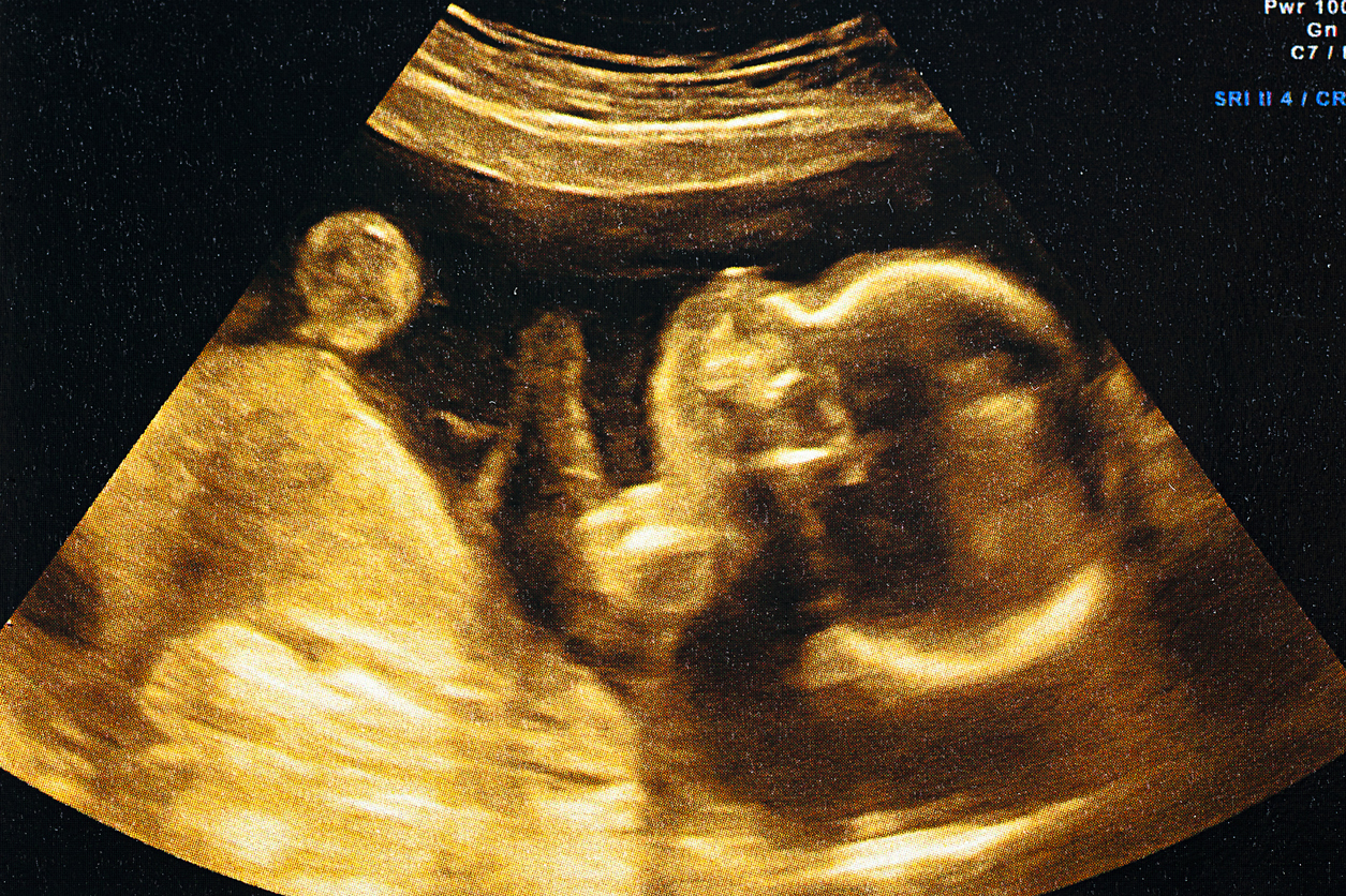 Бебе се роди от замразен ембрион след 16 години 